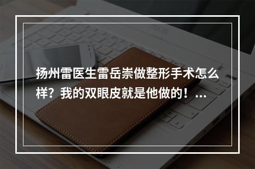 扬州雷医生雷岳崇做整形手术怎么样？我的双眼皮就是他做的！来看一下吧！