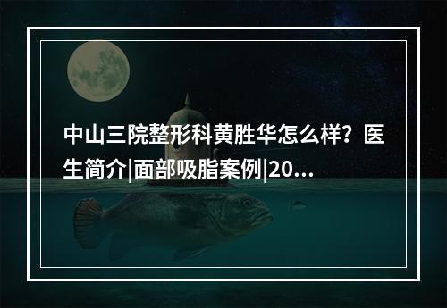 中山三院整形科黄胜华怎么样？医生简介|面部吸脂案例|2021价格表