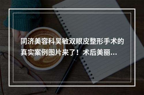 同济美容科吴敏双眼皮整形手术的真实案例图片来了！术后美丽加分100