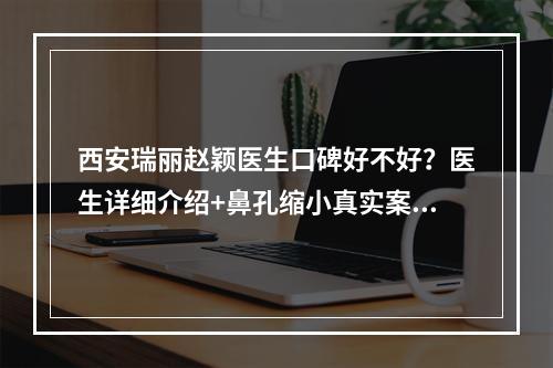 西安瑞丽赵颖医生口碑好不好？医生详细介绍+鼻孔缩小真实案例分享