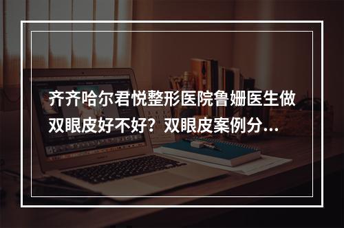 齐齐哈尔君悦整形医院鲁姗医生做双眼皮好不好？双眼皮案例分享！