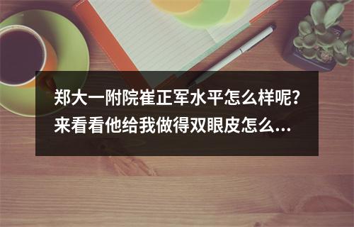 郑大一附院崔正军水平怎么样呢？来看看他给我做得双眼皮怎么样吧！