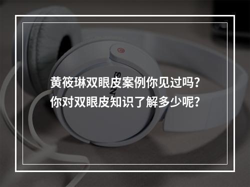 黄筱琳双眼皮案例你见过吗？你对双眼皮知识了解多少呢？