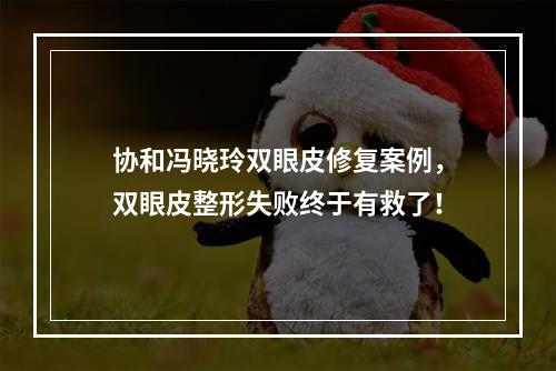 协和冯晓玲双眼皮修复案例，双眼皮整形失败终于有救了！