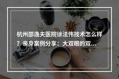 杭州邵逸夫医院徐法伟技术怎么样？亲身案例分享：大双眼的双倍快乐~