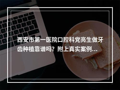 西安市第一医院口腔科党亮生做牙齿种植靠谱吗？附上真实案例分享！