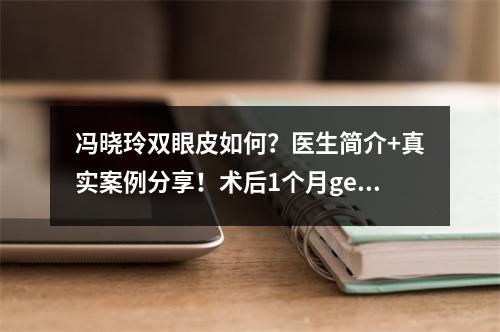 冯晓玲双眼皮如何？医生简介+真实案例分享！术后1个月get水灵双眼