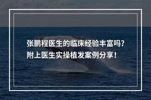 张鹏程医生的临床经验丰富吗？附上医生实操植发案例分享！