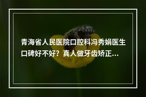 青海省人民医院口腔科冯秀娟医生口碑好不好？真人做牙齿矫正全过程记录！