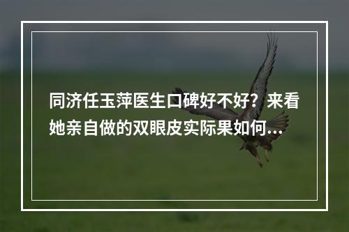 同济任玉萍医生口碑好不好？来看她亲自做的双眼皮实际果如何吧