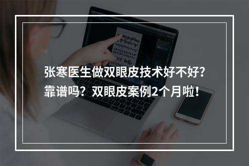 张寒医生做双眼皮技术好不好？靠谱吗？双眼皮案例2个月啦！