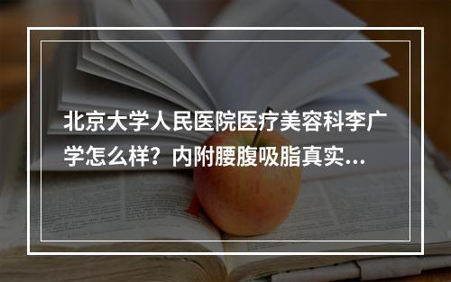 北京大学人民医院医疗美容科李广学怎么样？内附腰腹吸脂真实案例