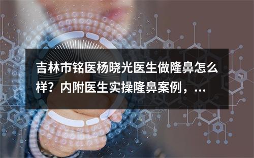 吉林市铭医杨晓光医生做隆鼻怎么样？内附医生实操隆鼻案例，高挺自然~