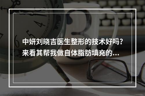 中妍刘晓吉医生整形的技术好吗？来看其帮我做自体脂肪填充的真实果吧