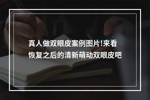 真人做双眼皮案例图片!来看恢复之后的清新萌动双眼皮吧