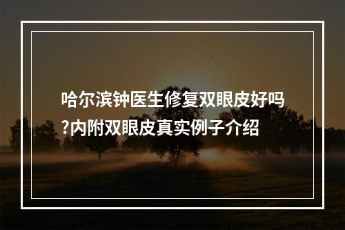 哈尔滨钟医生修复双眼皮好吗?内附双眼皮真实例子介绍