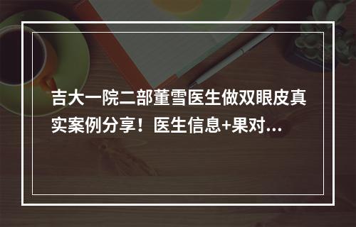 吉大一院二部董雪医生做双眼皮真实案例分享！医生信息+果对比