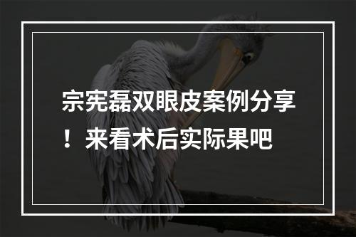 宗宪磊双眼皮案例分享！来看术后实际果吧