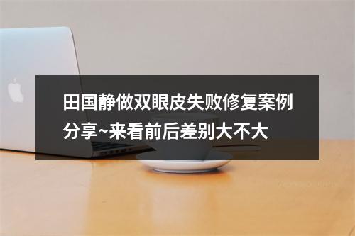 田国静做双眼皮失败修复案例分享~来看前后差别大不大