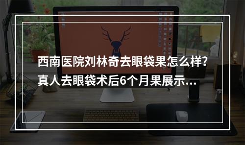 西南医院刘林奇去眼袋果怎么样？真人去眼袋术后6个月果展示~