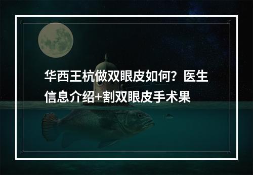 华西王杭做双眼皮如何？医生信息介绍+割双眼皮手术果