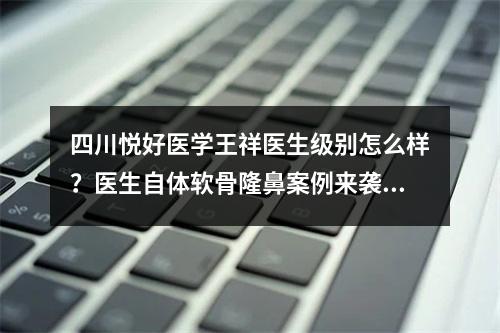 四川悦好医学王祥医生级别怎么样？医生自体软骨隆鼻案例来袭~