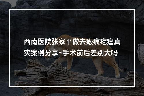 西南医院张家平做去瘢痕疙瘩真实案例分享~手术前后差别大吗