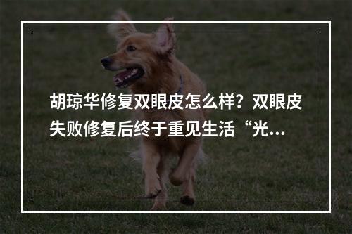 胡琼华修复双眼皮怎么样？双眼皮失败修复后终于重见生活“光明”