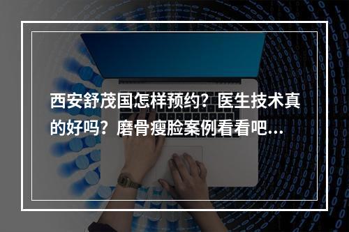 西安舒茂国怎样预约？医生技术真的好吗？磨骨瘦脸案例看看吧！