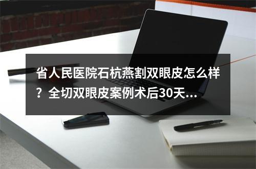 省人民医院石杭燕割双眼皮怎么样？全切双眼皮案例术后30天报道