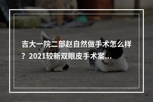 吉大一院二部赵自然做手术怎么样？2021较新双眼皮手术案例附上！