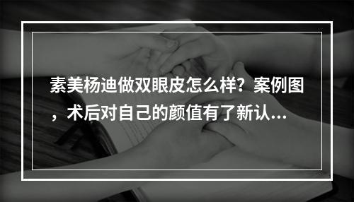 素美杨迪做双眼皮怎么样？案例图，术后对自己的颜值有了新认知！