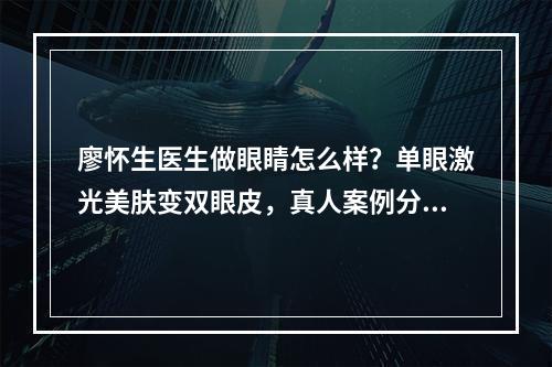 廖怀生医生做眼睛怎么样？单眼激光美肤变双眼皮，真人案例分享~