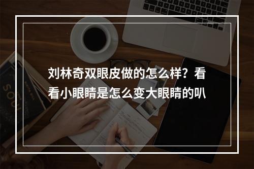 刘林奇双眼皮做的怎么样？看看小眼睛是怎么变大眼睛的叭