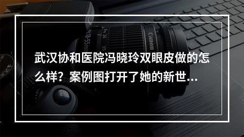 武汉协和医院冯晓玲双眼皮做的怎么样？案例图打开了她的新世界！