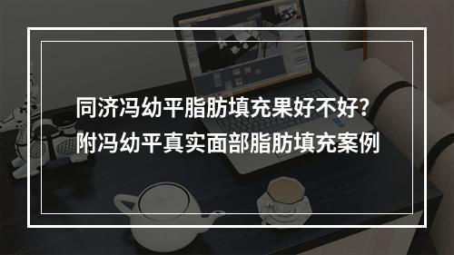 同济冯幼平脂肪填充果好不好？附冯幼平真实面部脂肪填充案例