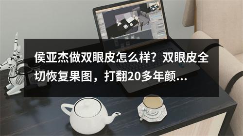 侯亚杰做双眼皮怎么样？双眼皮全切恢复果图，打翻20多年颜值