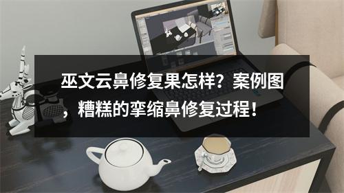 巫文云鼻修复果怎样？案例图，糟糕的挛缩鼻修复过程！