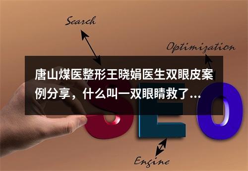 唐山煤医整形王晓娟医生双眼皮案例分享，什么叫一双眼睛救了一张脸！