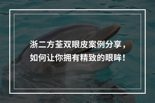 浙二方荃双眼皮案例分享，如何让你拥有精致的眼眸！