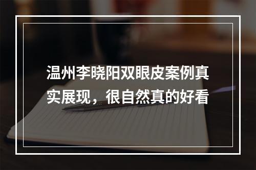 温州李晓阳双眼皮案例真实展现，很自然真的好看