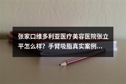 张家口维多利亚医疗美容医院张立平怎么样？手臂吸脂真实案例参考