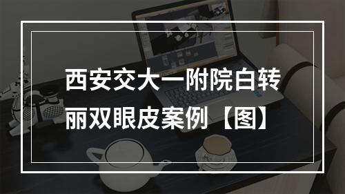 西安交大一附院白转丽双眼皮案例【图】