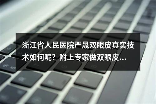 浙江省人民医院严晟双眼皮真实技术如何呢？附上专家做双眼皮果