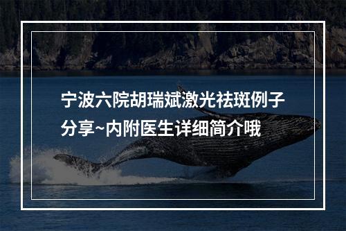 宁波六院胡瑞斌激光祛斑例子分享~内附医生详细简介哦