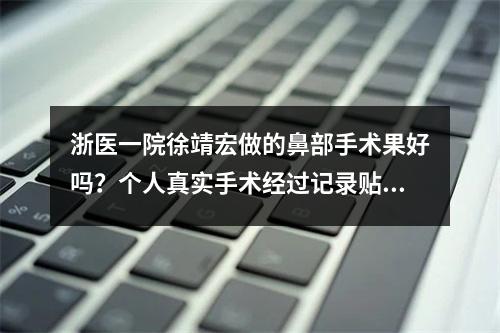 浙医一院徐靖宏做的鼻部手术果好吗？个人真实手术经过记录贴~