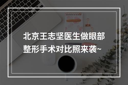 北京王志坚医生做眼部整形手术对比照来袭~