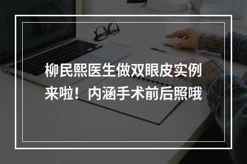 柳民熙医生做双眼皮实例来啦！内涵手术前后照哦