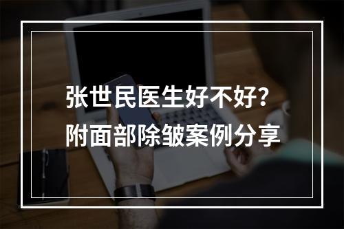 张世民医生好不好？附面部除皱案例分享