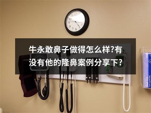 牛永敢鼻子做得怎么样?有没有他的隆鼻案例分享下?